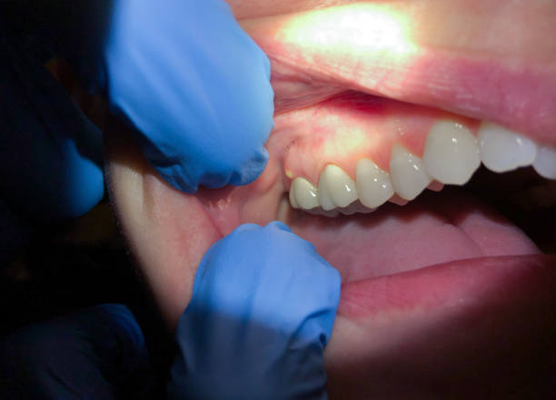 Best Emergency Dentist for Special Needs Patients in Thomson, GA