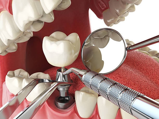 Best Emergency Dental Services for Seniors in Thomson, GA